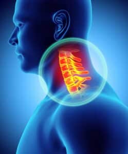 Graphic of focus on a man's neck, highlighting the skeleton structure of his neck